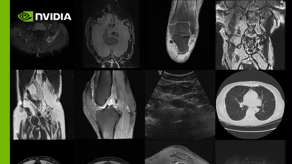 Create Infinite Medical Imaging Data With Generative AI