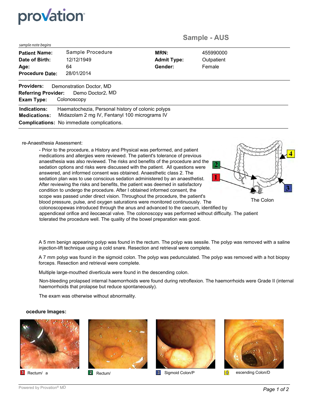 Colonoscopy Procedure Note Sample Provation Gastroenterology