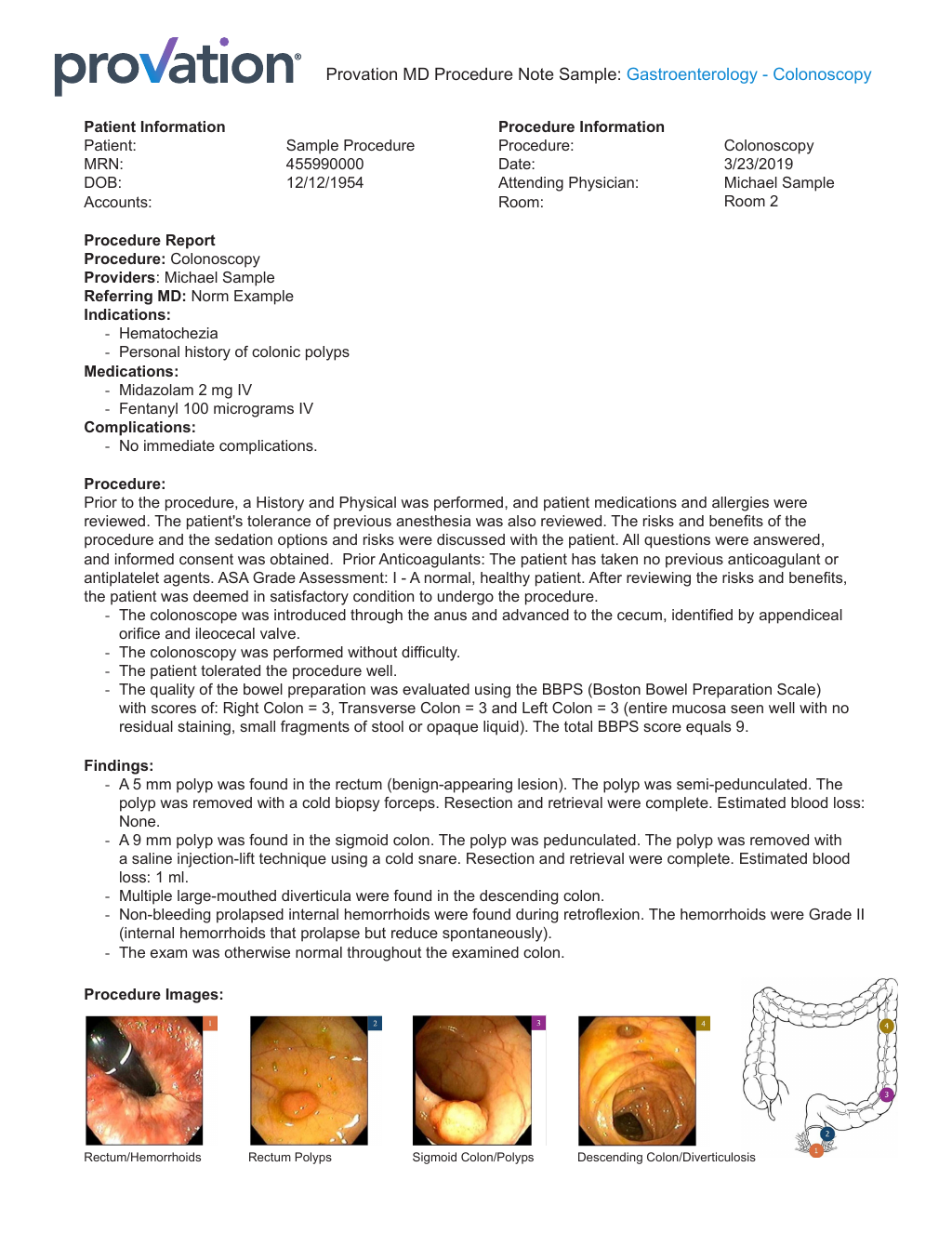 Colonoscopy Procedure Note Example Provation Apex