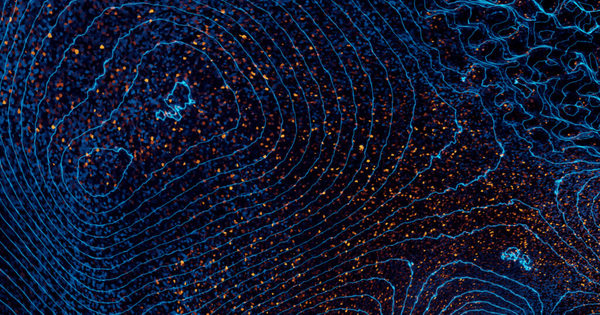 Sample content thumbnail