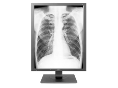 Diagnostic Monitors | Medical Grade | LG US Business